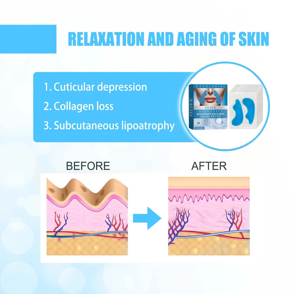 Nasolabial Fold Gel Patches – Anti-Wrinkle & Firming | Eelhoe Anti-Wrinkle Face Patches Zpaxo