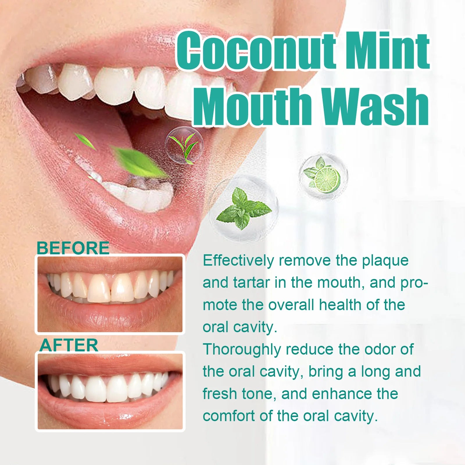Coconut Mouthwash for Fresh Breath and Teeth Whitening Remove Bad Odor Plaque Tartar Alcohol Free Gentle Oral Care Rinse 100ml Zpaxo