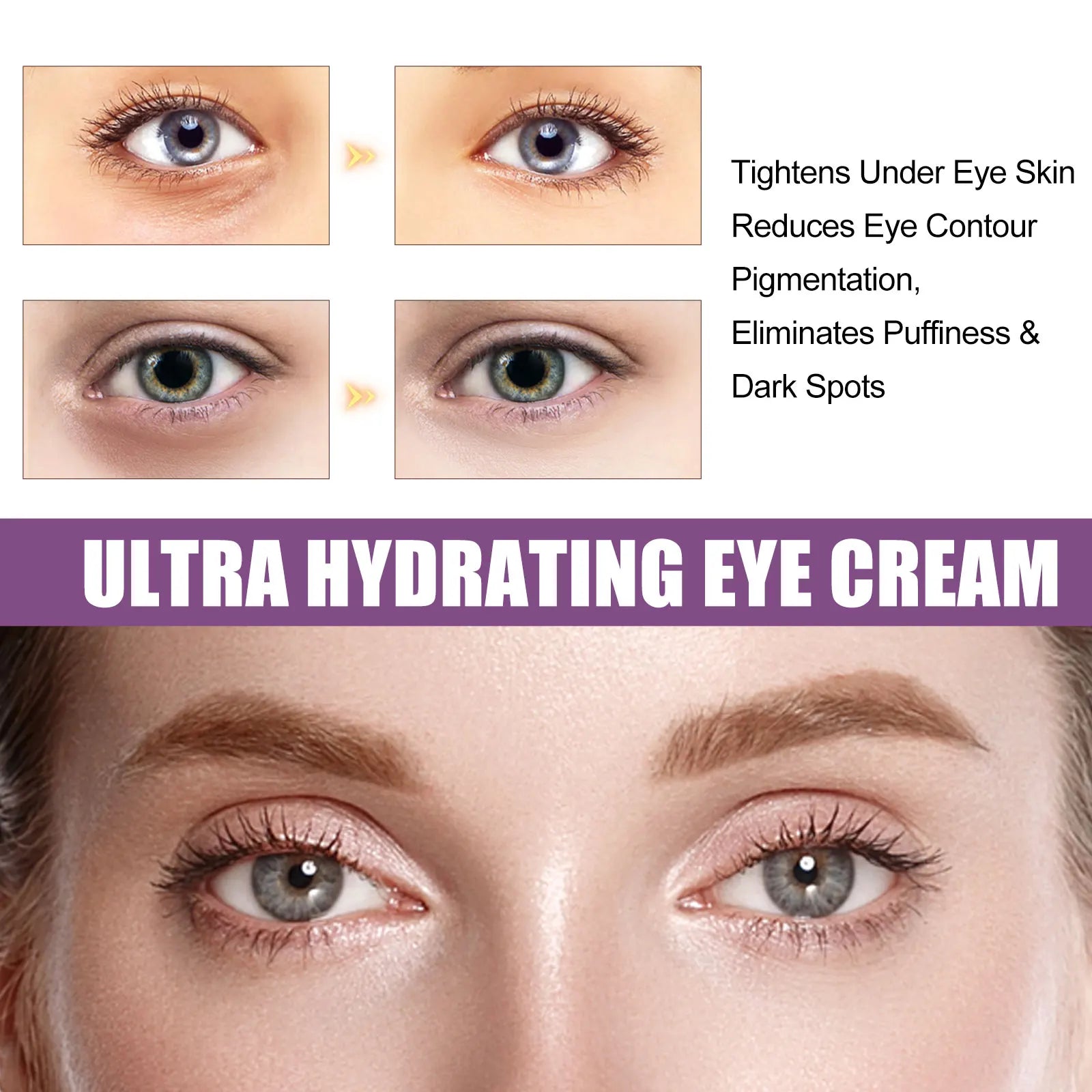 EELHOE Ultra Hydrating Eye Cream – Dark Circles & Wrinkles Eye Cream Zpaxo