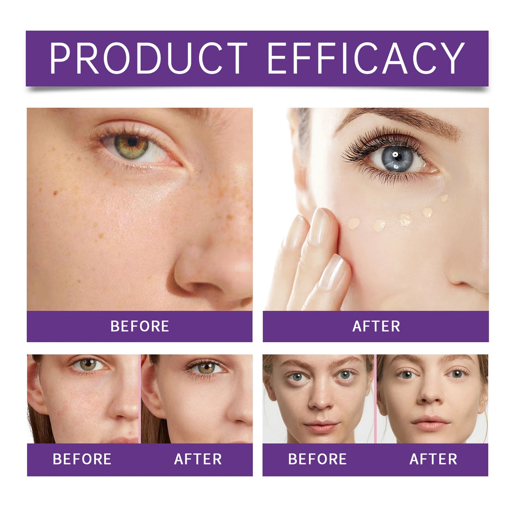 Concealer Improve Skin Elasticity Brighten Complexion Not Easy Remove Makeup Moisturizing Liquid Lightweight Dark Circle Blemish Zpaxo