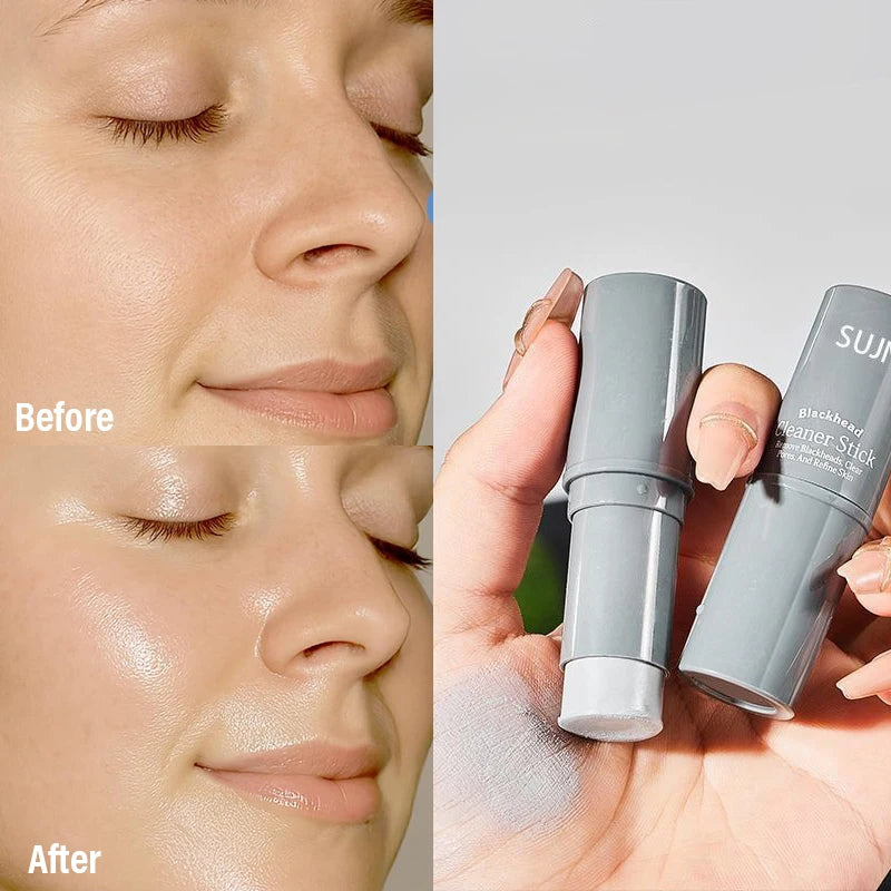 Original Facial Remove Blackhead Stick Solid Mask Treat Acne Blemish Black Dots Deep Cleansing Cream Shrink Pores Skin Care 9g Zpaxo
