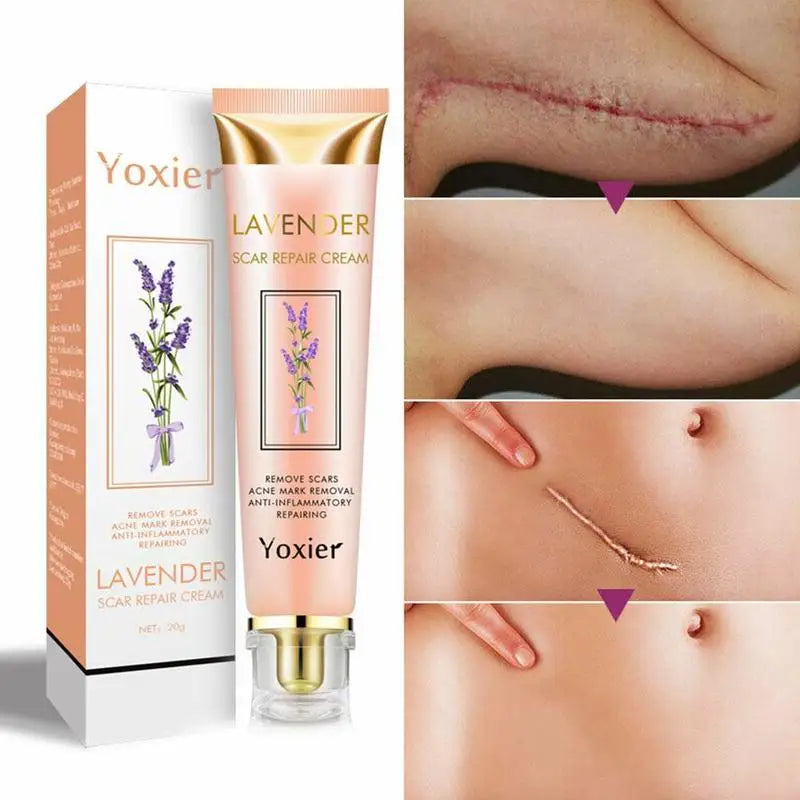 Lavender Scar Repair Cream – Fades Acne Marks & Smoothes Skin Scar Repair Cream Zpaxo