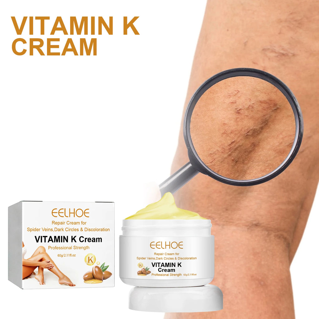 Vitamin K Cream for Varicose Veins, Spider Veins & Leg Relief Vitamin K Skin Cream Zpaxo
