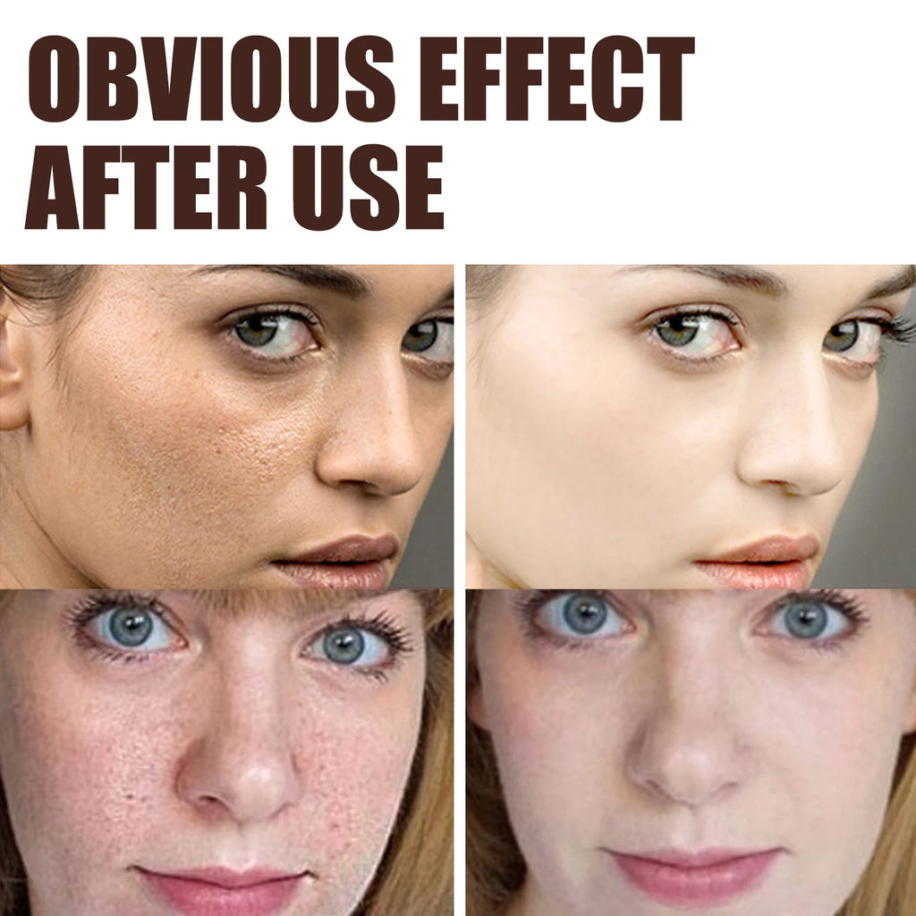 Double Retinol Facial Cream Anti-aging Fade Fine Line Wrinkle Firming Lifting Repair Skin Barrier Brightening Moisturizing Cream Zpaxo