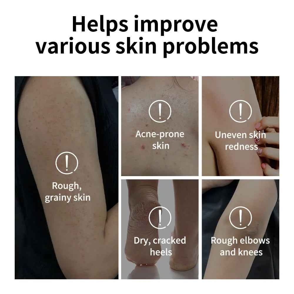 Glycolic Acid Exfoliating Body Stick Multiple Concerns Delivers Deep Effective Exfoliation Nourishing Moisture Deep Hydration Zpaxo