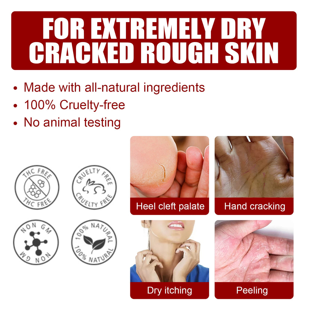 AHA Exfoliating Foot Mask Moisturizing Anti Crack Heel Foot Calluses Dead Skin Remover Smooth & Soft Feet Care Foot Patch Zpaxo