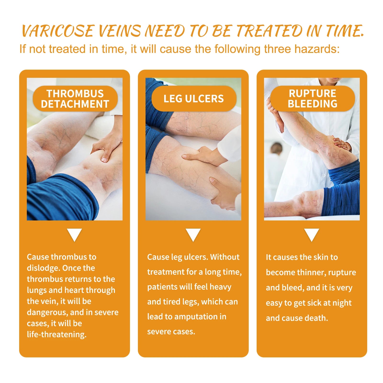 Vitamin K Cream for Varicose Veins, Spider Veins & Leg Care Vitamin K Skin Cream Zpaxo