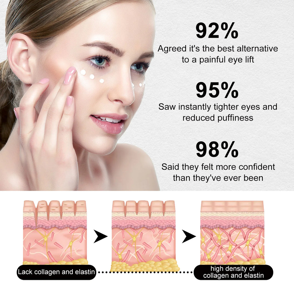 Hoygi 30ml Peptide Collagen Eye Cream Reduce Dark Circles Puffiness and Fine Lines Firming and Hydrating Under Eye Treatment Zpaxo