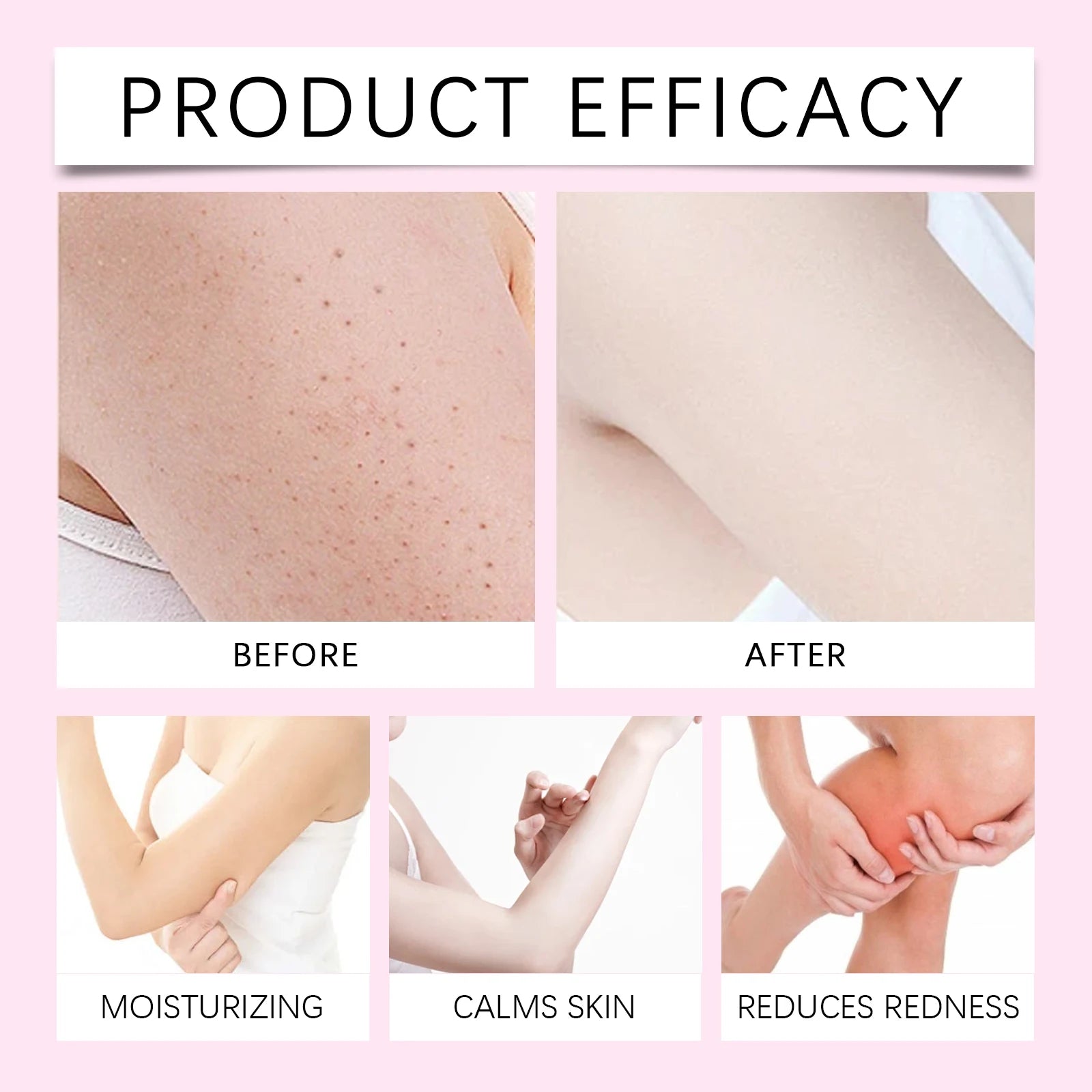 Post Hair Removal Oil Soothing Redness Moisturizing Without Greasiness Body Serum After Shave Care Smooth Skin Aloe Vera 30ml Zpaxo