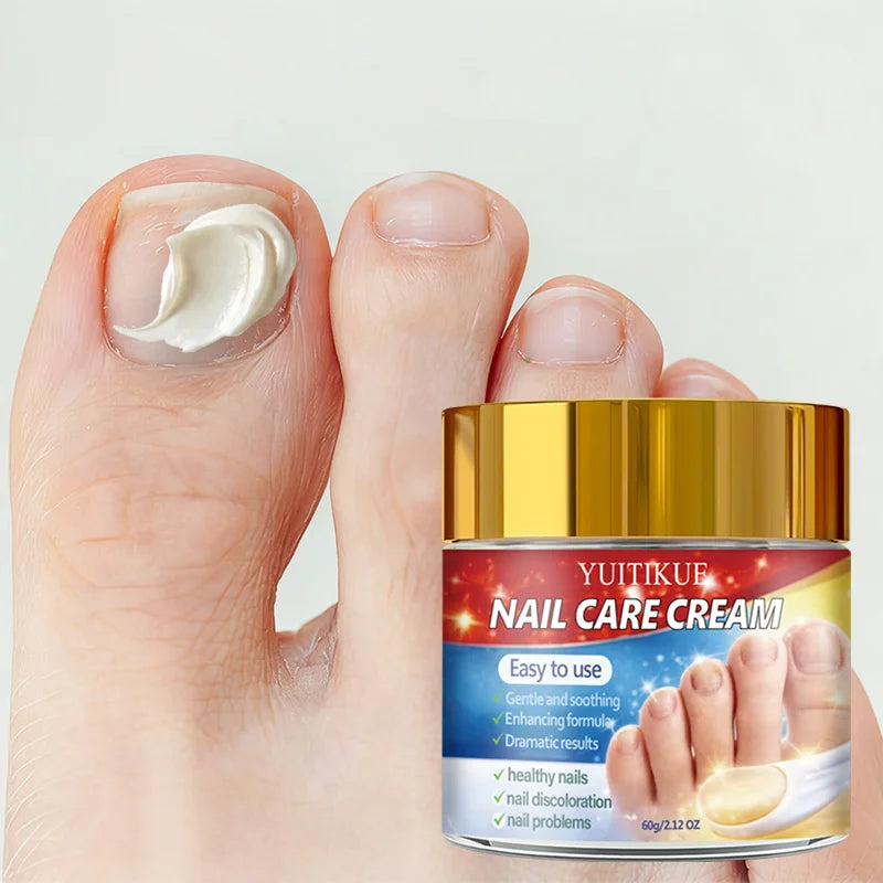 YUITIKUE Nail Repair Cream – Retinol & Collagen Formula 60g Nail Repair Cream Zpaxo