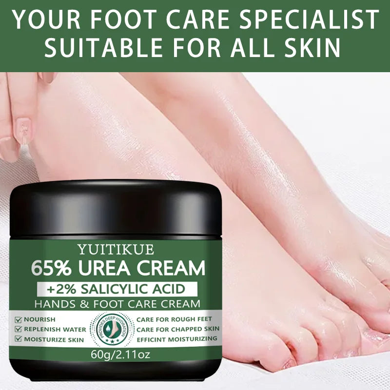 YUITIKUE 65% Urea Foot & Hand Cream – Cracked Skin Repair 60g Foot & Hand Cream Zpaxo
