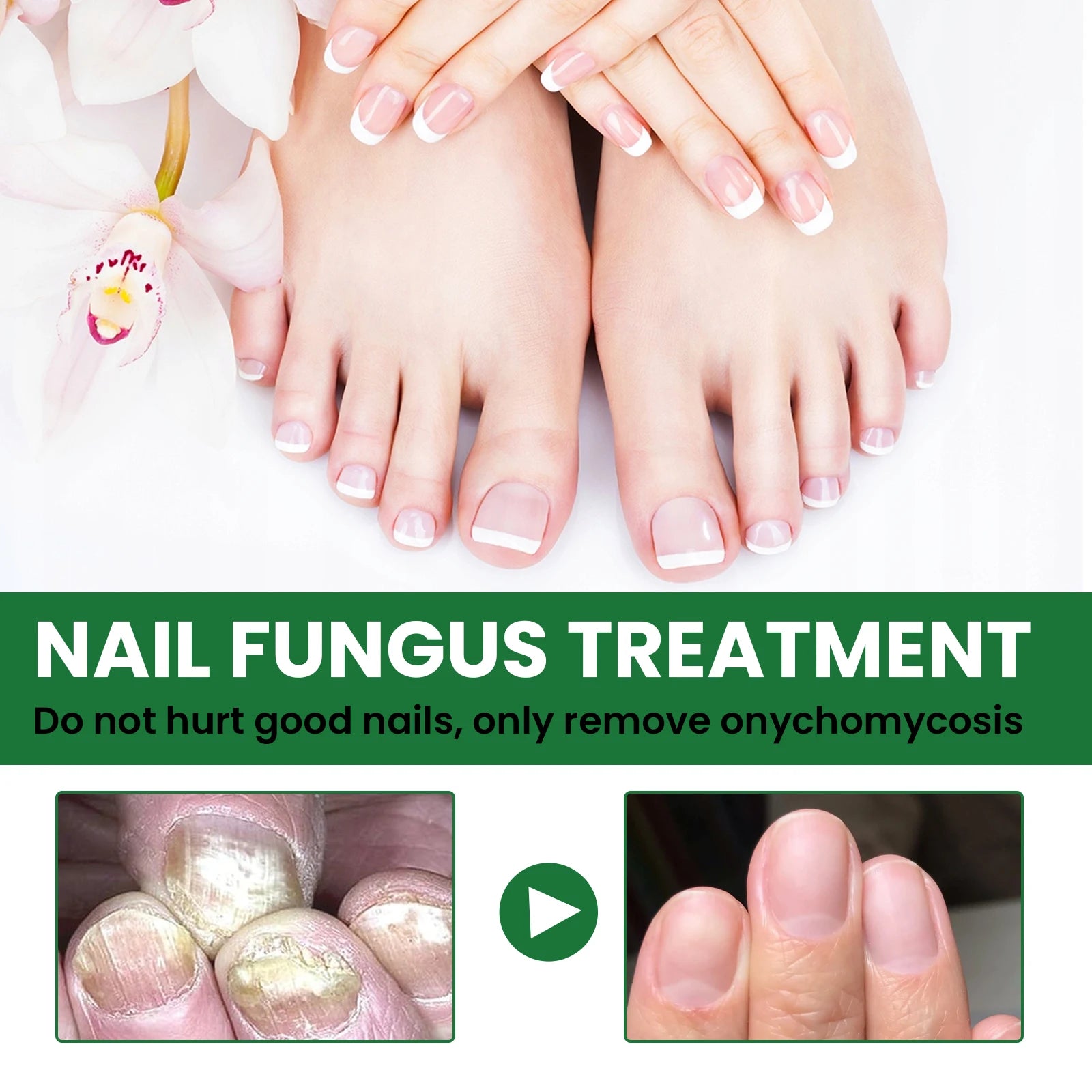 Nail Repair & Strengthening LiquidRepairs and nourishes nails, brightens, moisturizes and protects, for hand & foot nail care. Zpaxo
