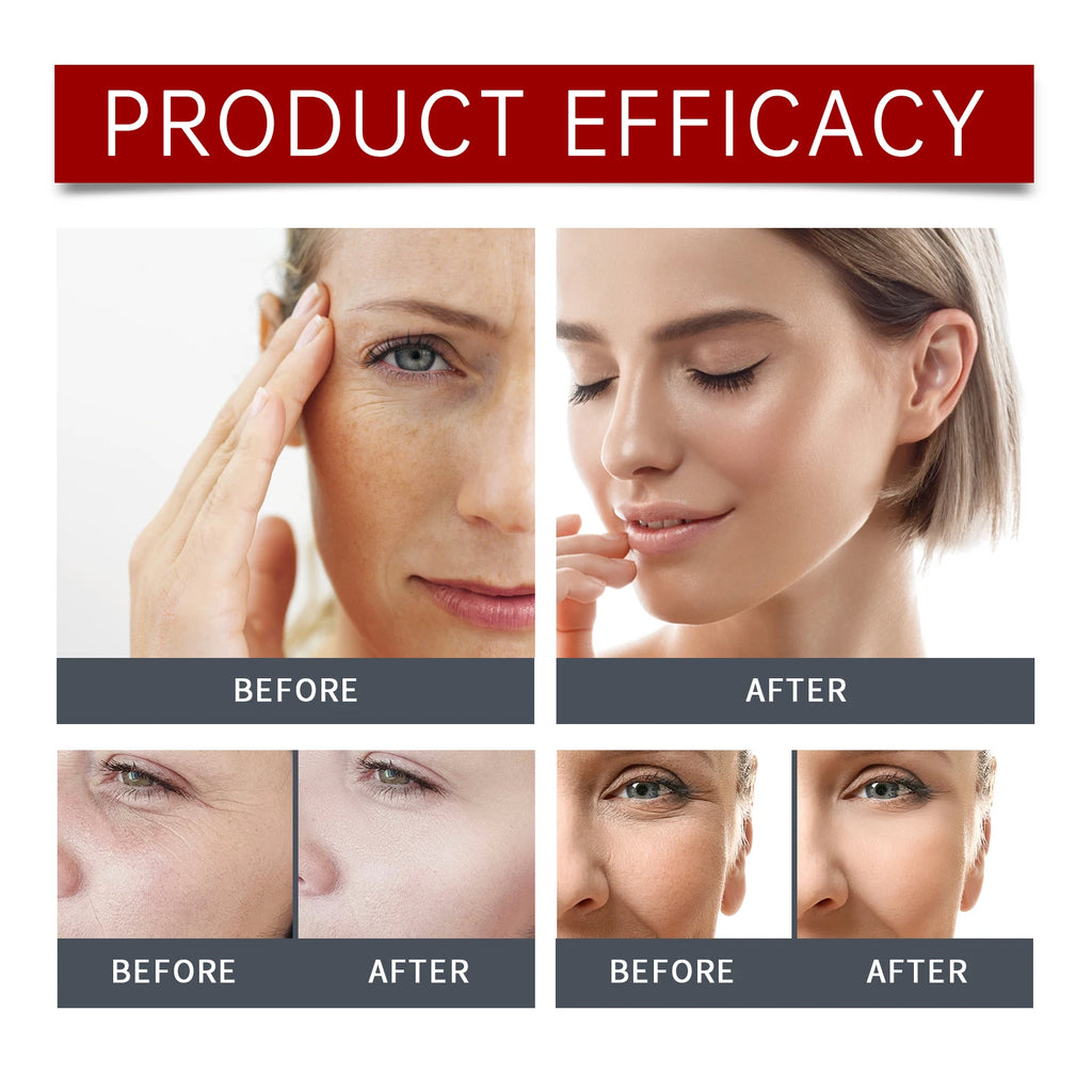 Hoygi Collagen Face Serum 30ml Firming Line Smoothing Essence Golden Button Flower Extract for Youthful Glow Sensitive Skin Zpaxo