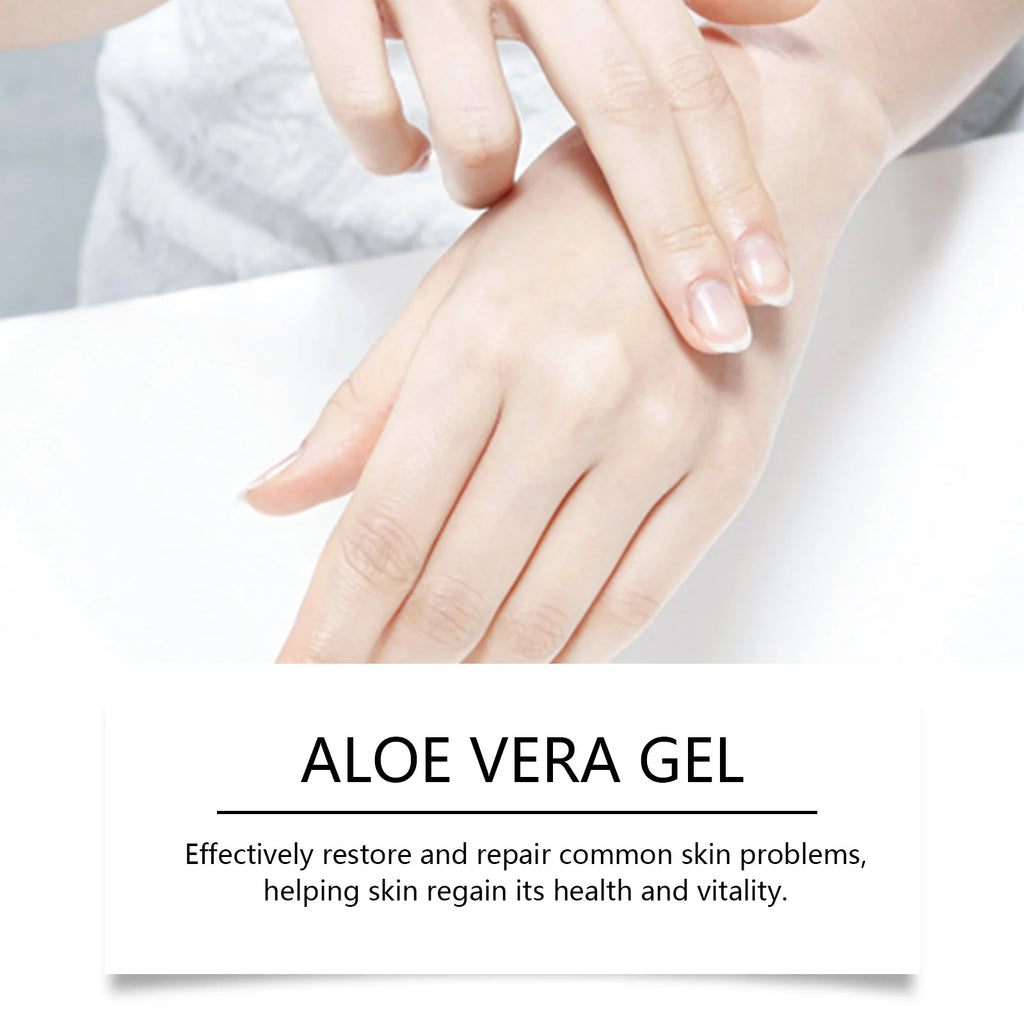 Aloe Vera Gel Nourish Moisturize Smooth Soften Soothe Face Prevent Acne Pimple Redness Cracked Rough Moisturizing Aloe Vera Gel Zpaxo