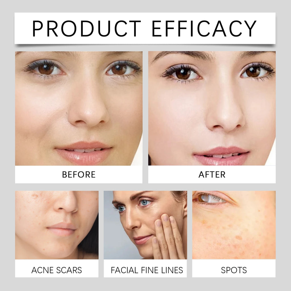 Hoygi Vitamin C Walnut Antioxidant Cream Brightening Tone Evening Dark Spot Correcting Hydrating Lightweight Fast Absorbing Skin Zpaxo