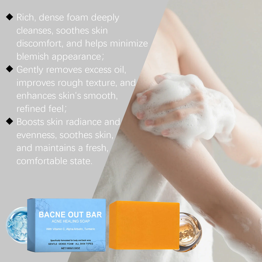 Hoygi Anti-Acne Brightening Exfoliating Body & Facial Soap Cleansing Bar Soap Zpaxo