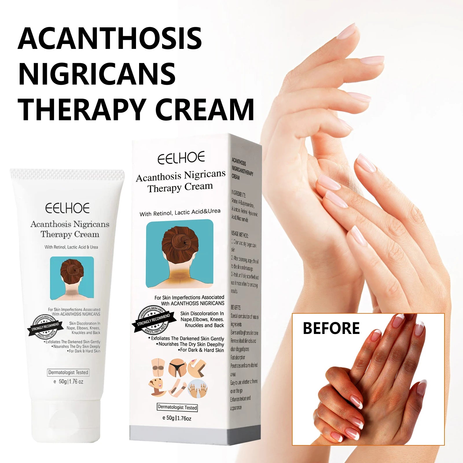 EELHOE Whitening Cream – Body Brightening for Dark Skin Skin Brightening Cream Zpaxo