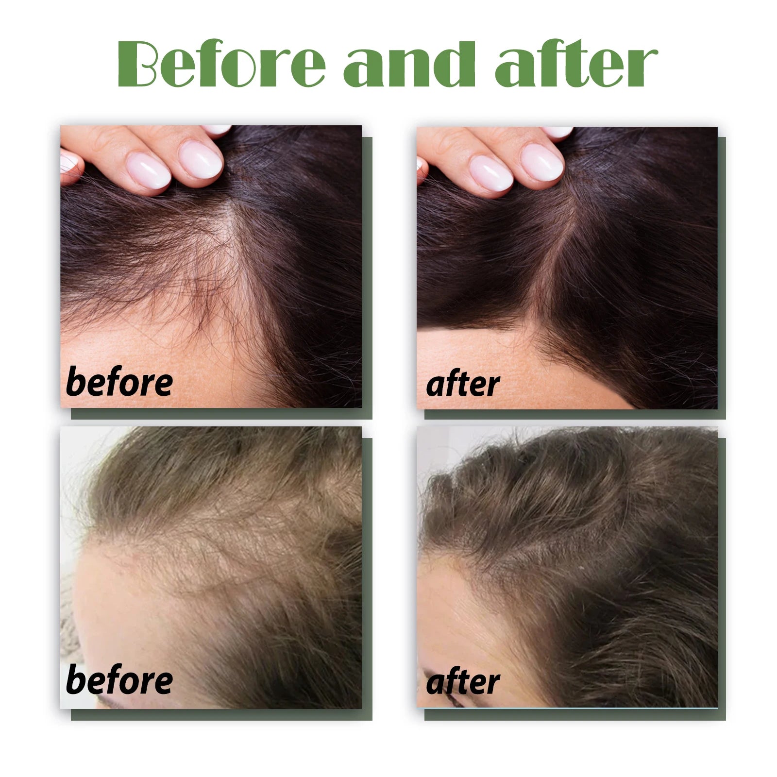 Ouhoe Hair Growth Support Spray with Herbal Extracts Nourishing Scalp Tonic for Thinning Hair Strengthen Roots Shine 120ml Zpaxo