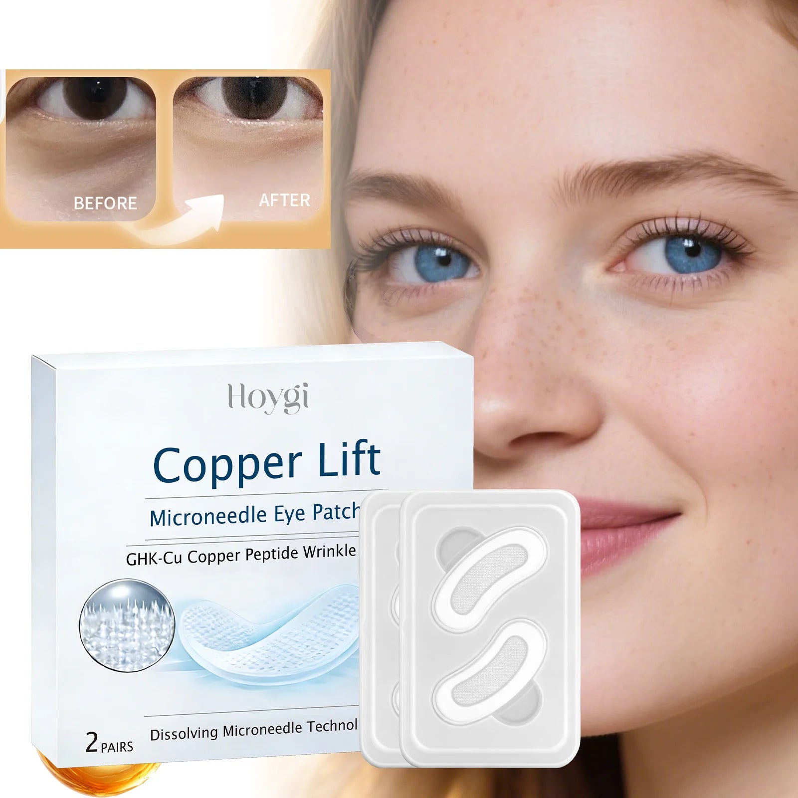 Hoygi Microneedle Eye Patches – Dark Circles & Puffiness Relief Eye Patch Mask Zpaxo