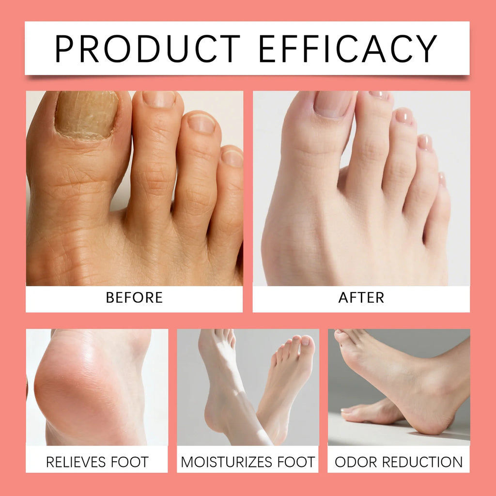 5 Pairs Peach Scented Foot Mask Heavy Moisturizer for Dry & Cracked Heels Callus Remover Socks for Soft Smooth Feet at Home Zpaxo