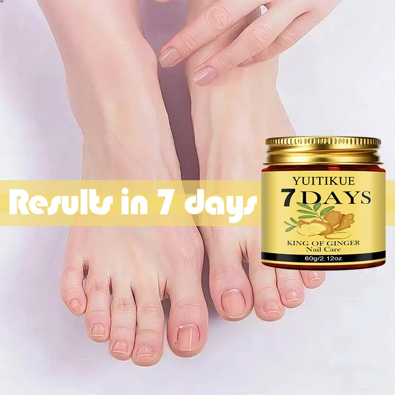 YUITIKUE 7-Day Ginger King Nail Care Cream – Renew Nails 60g Nail Treatment Cream Zpaxo