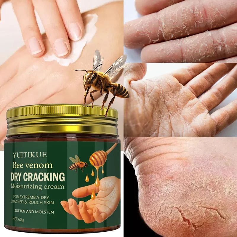 Bee Venom Repair Cream 60g – Dry & Cracked Hands & Feet Foot & Hand Cream Zpaxo Default Title