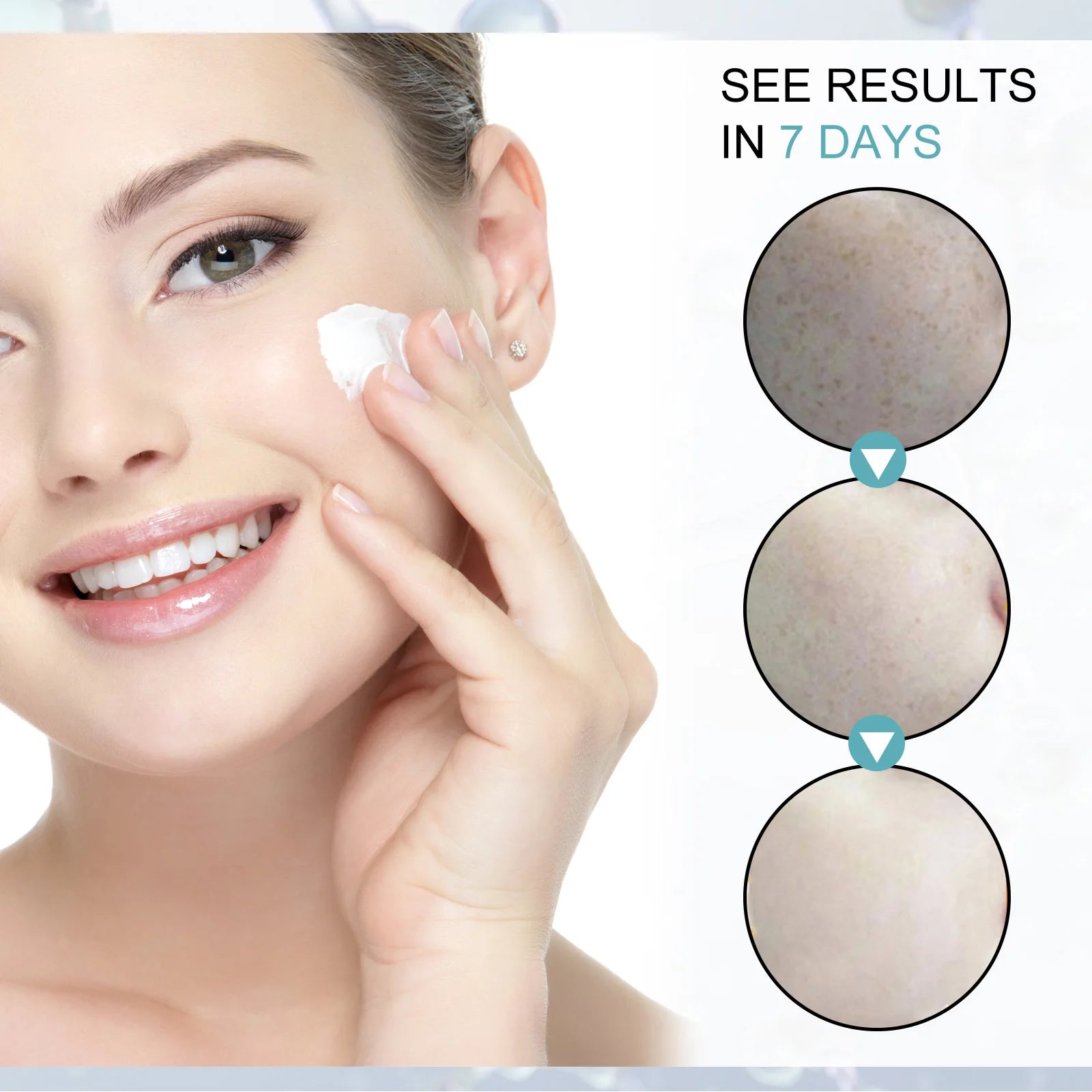 Freckle Whitening Cream Nicotinamide Fade Dark Spot Blemish Acne Mark Brightening Lightening Pigmentation Correction Cream Zpaxo
