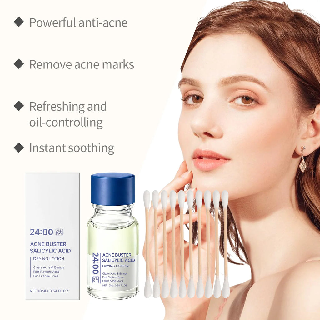 Hoygi Salicylic Acid Acne Serum – Blackhead & Pore Control Acne Spot Treatment Zpaxo