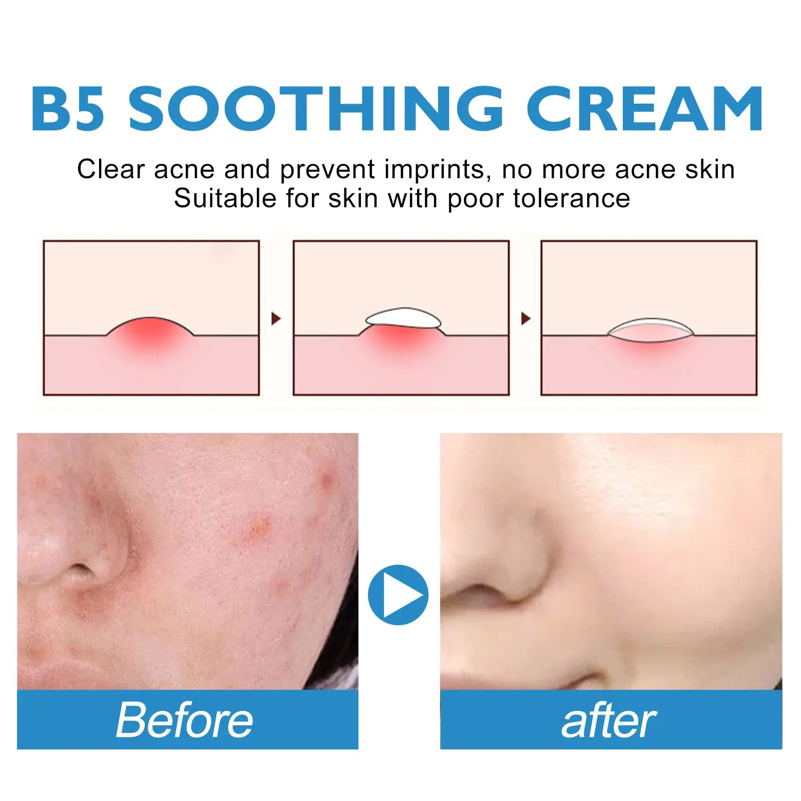 Eelhoe B5 Repair Cream – Soothing Hydrating Face Moisturizer Face Repair Cream Zpaxo