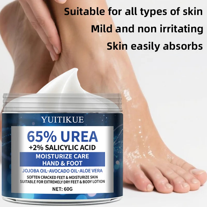 YUITIKUE 65% Urea Foot Cream – Cracked Heel Repair, 60g Urea Foot Cream Zpaxo