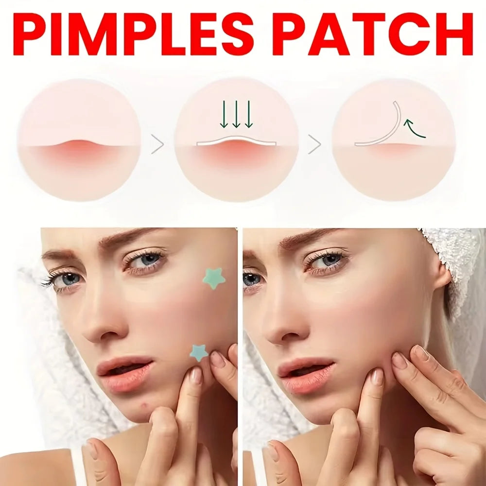 Colorful PE Pimple Patches Cute Star Shaped Cover Sticker Invisible Zpaxo
