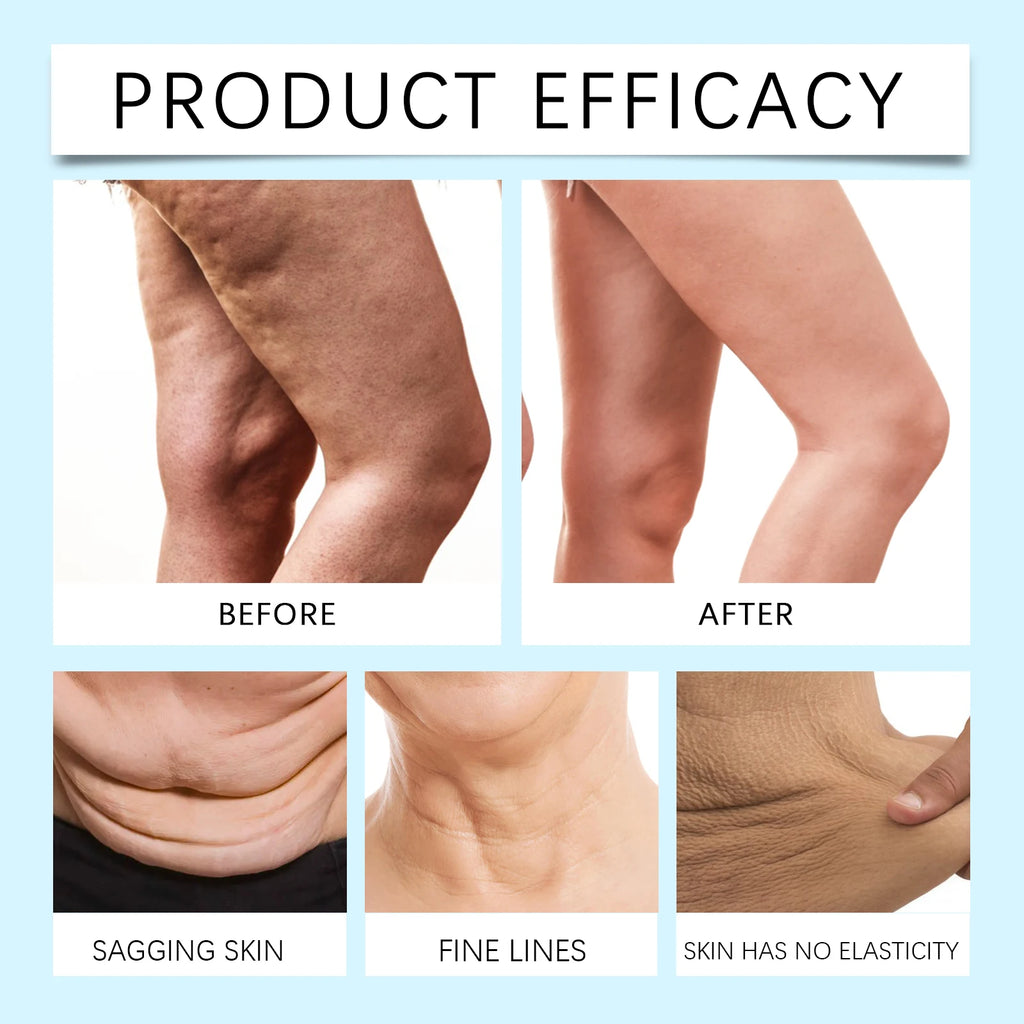 Retinol Body Butter Cream Anti Wrinkle Firming Moisturizer for Sagging Skin Deep Hydration Stretch Marks Vitamin B5 All Skin 60g Zpaxo