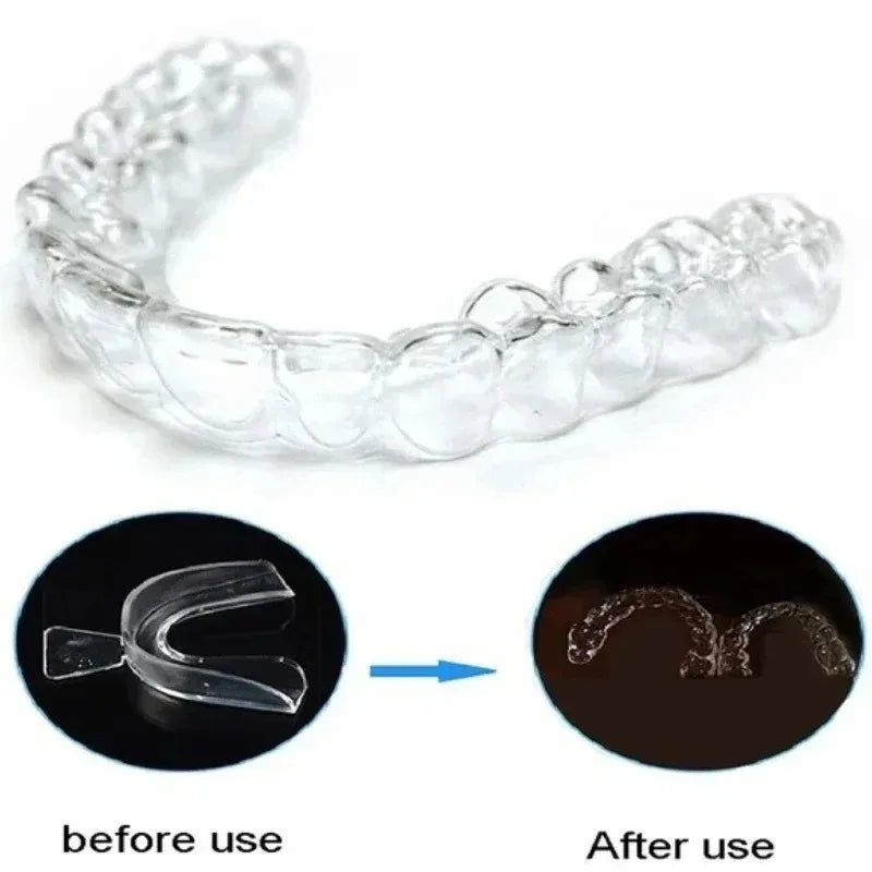 Custom-Fit Night Guard Mouth Tray – Stop Teeth Grinding