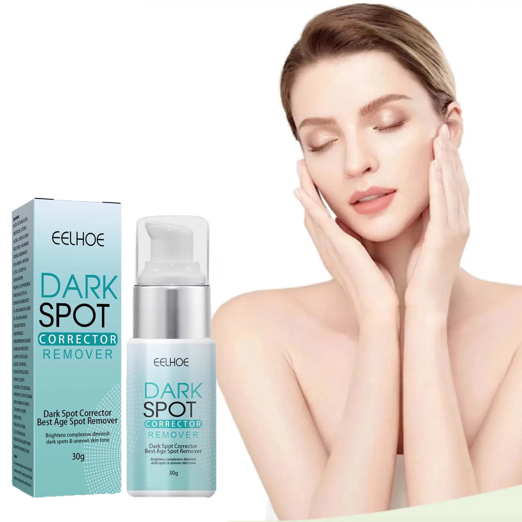 Freckle Whitening Cream Nicotinamide Fade Dark Spot Blemish Acne Mark Brightening Lightening Pigmentation Correction Cream Zpaxo
