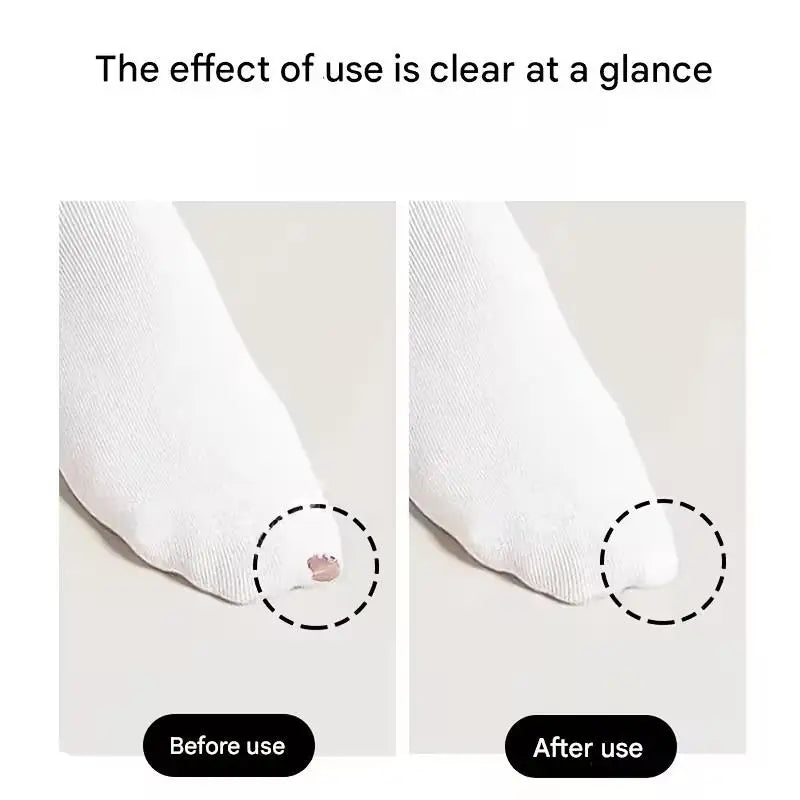 2pcs Washable Mending Patches for Socks, Down Jackets, Umbrellas, Durable Restoration Repair Zpaxo