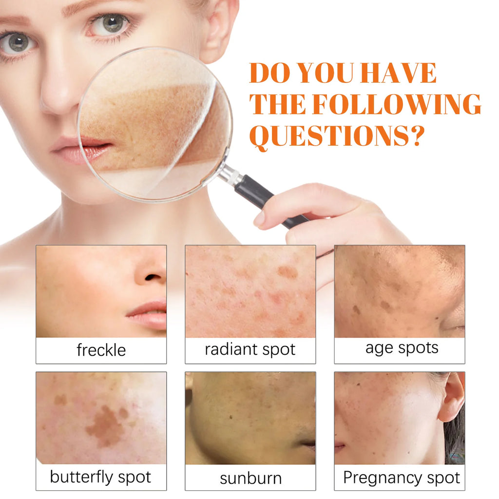 Papaya Day & Night Face Cream Set – Dark Spot & Freckle Corrector Brightening Face Cream Zpaxo