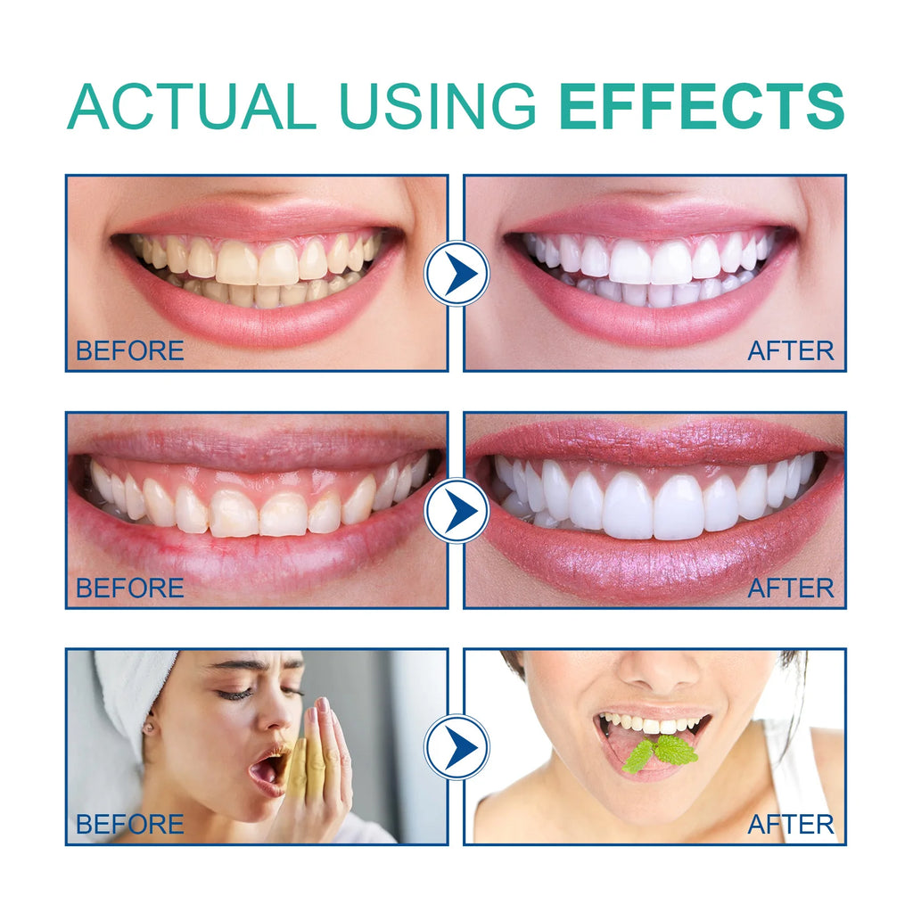 Coconut Mouthwash for Fresh Breath and Teeth Whitening Remove Bad Odor Plaque Tartar Alcohol Free Gentle Oral Care Rinse 100ml Zpaxo