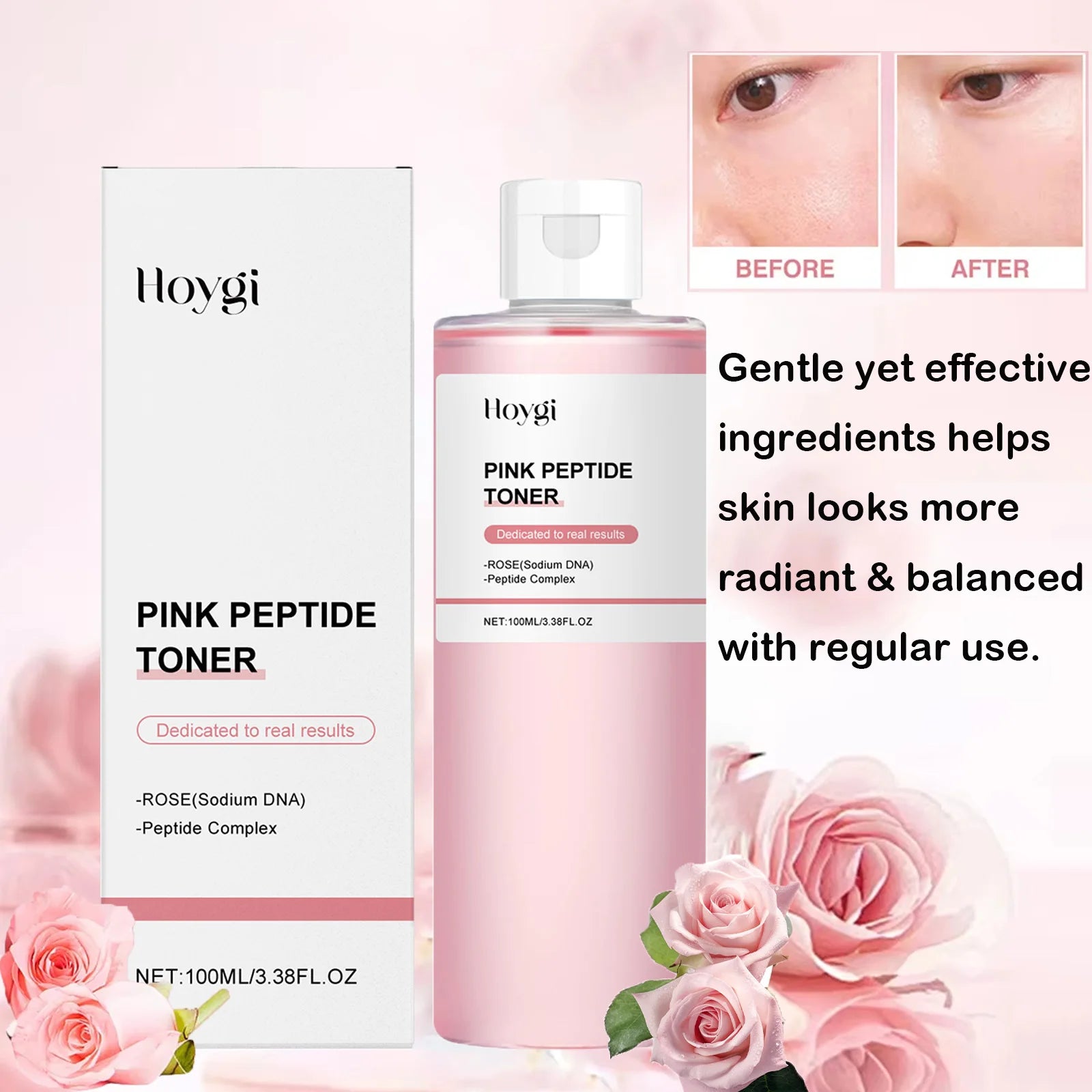 Hoygi Rose Peptide Toner – Hydrating, Brightening Facial Toner Facial Toner Zpaxo