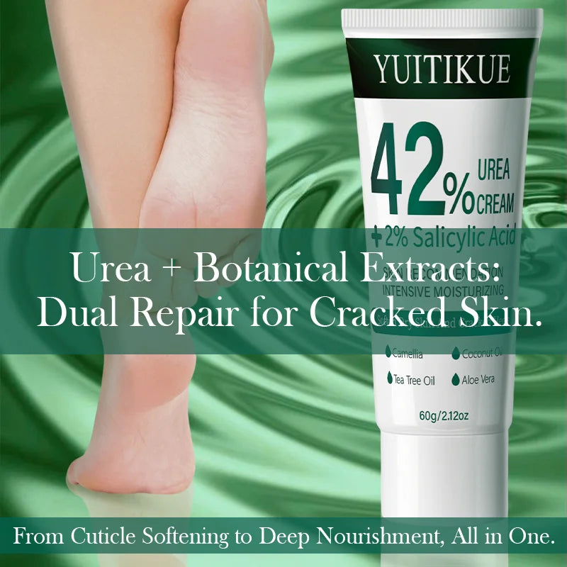YUITIKUE 42% Urea Cream – Cuticle Softener & Dry Skin Relief 60g Urea Foot Cream Zpaxo