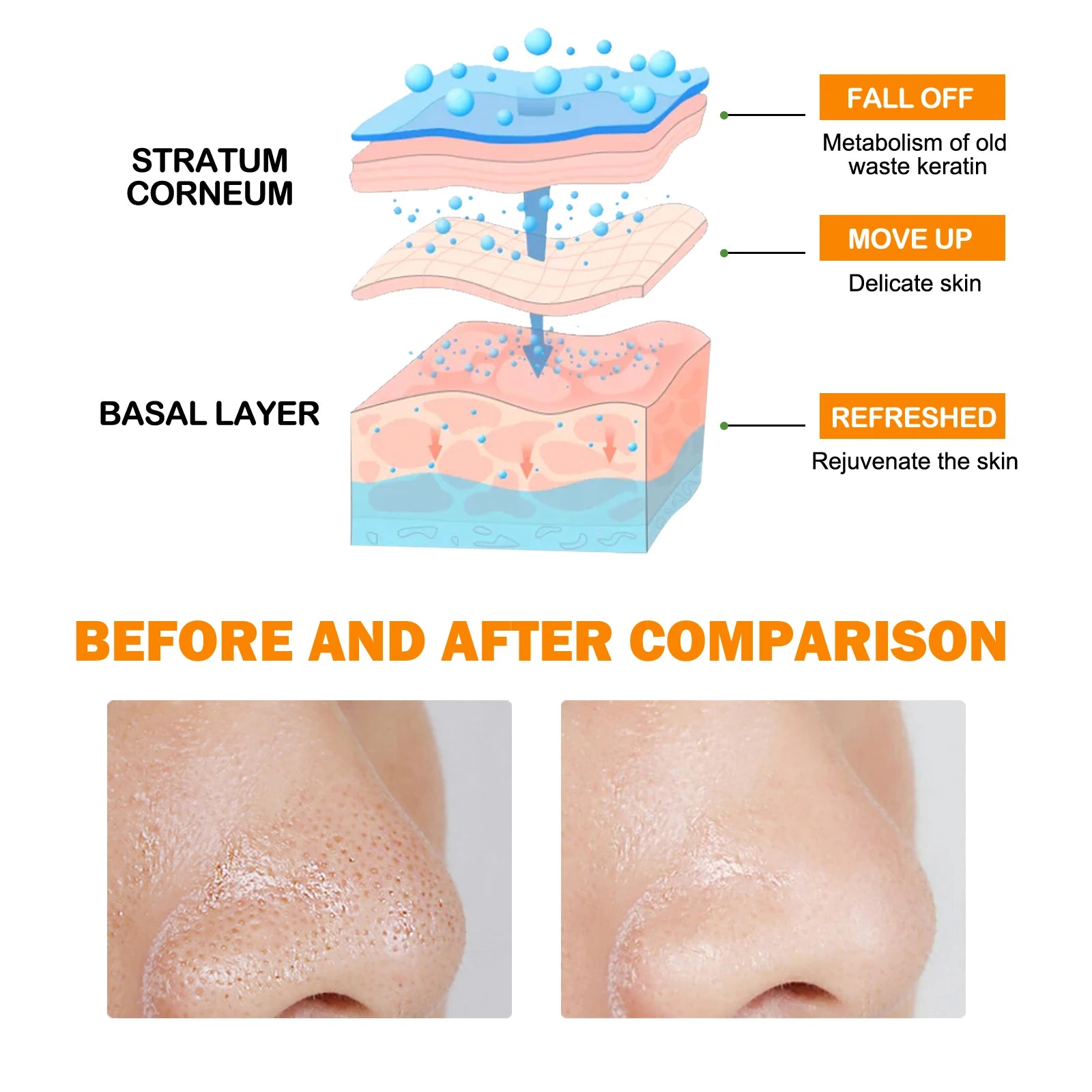 Hoygi Enzyme Exfoliating Gel – Salicylic Acid & Blackhead Remover Exfoliating Face Gel Zpaxo