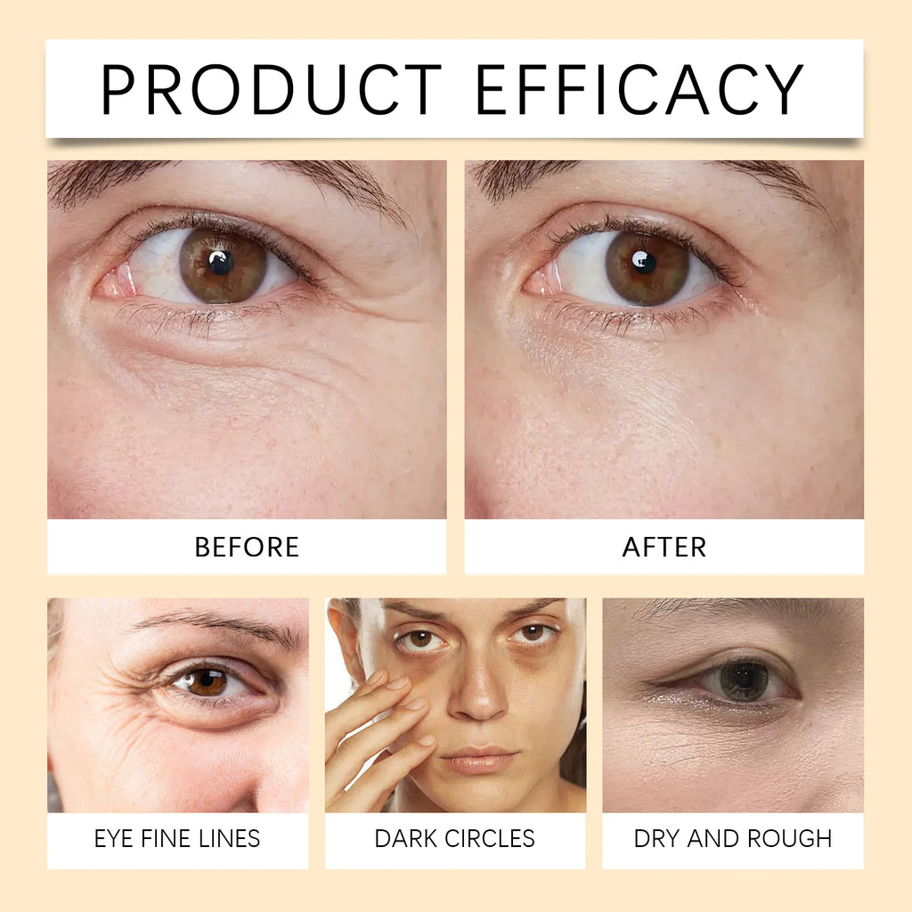 Firming Skin Eye Serum Oil Vitamin C and E for Dry Skin Facial for Wrinkles Hydrating Lightweight Fast Absorbing Skincare 10ml Zpaxo