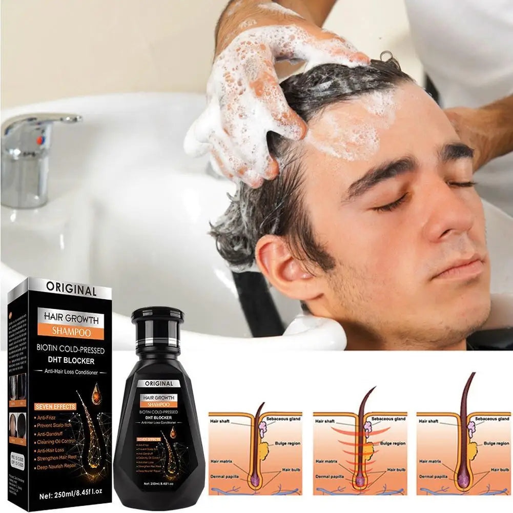 Ginger Hair Growth Shampoo – Cleanse, Soothe & Stimulate Hair Growth Shampoo Zpaxo