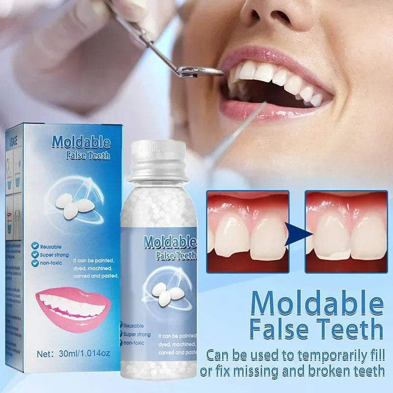 Temporary Tooth Repair Kit – Moldable Resin Dental Adhesive