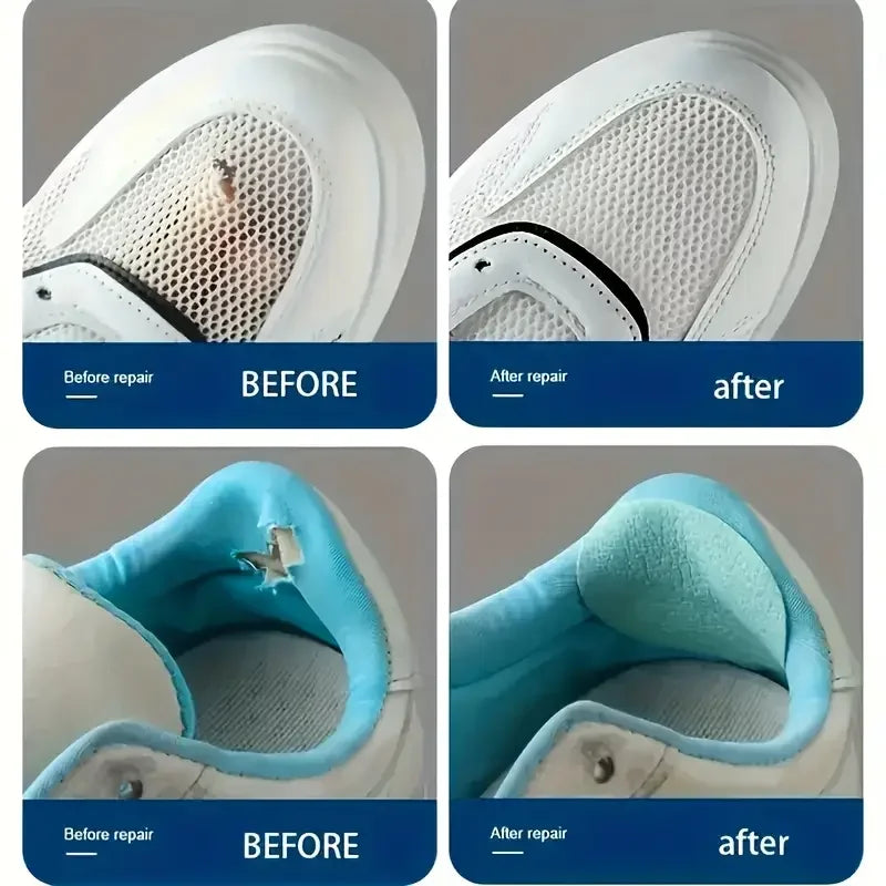 6PCS Strong Self-Adhesive Shoe Patches - Durable, Scratch & Wear Resistant - Sneaker Repair Kit for Damaged Shoes Zpaxo