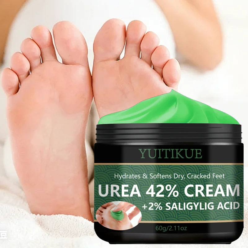 YUITIKUE 42% Urea Foot Cream – Callus & Dry Skin Relief Urea Foot Cream Zpaxo
