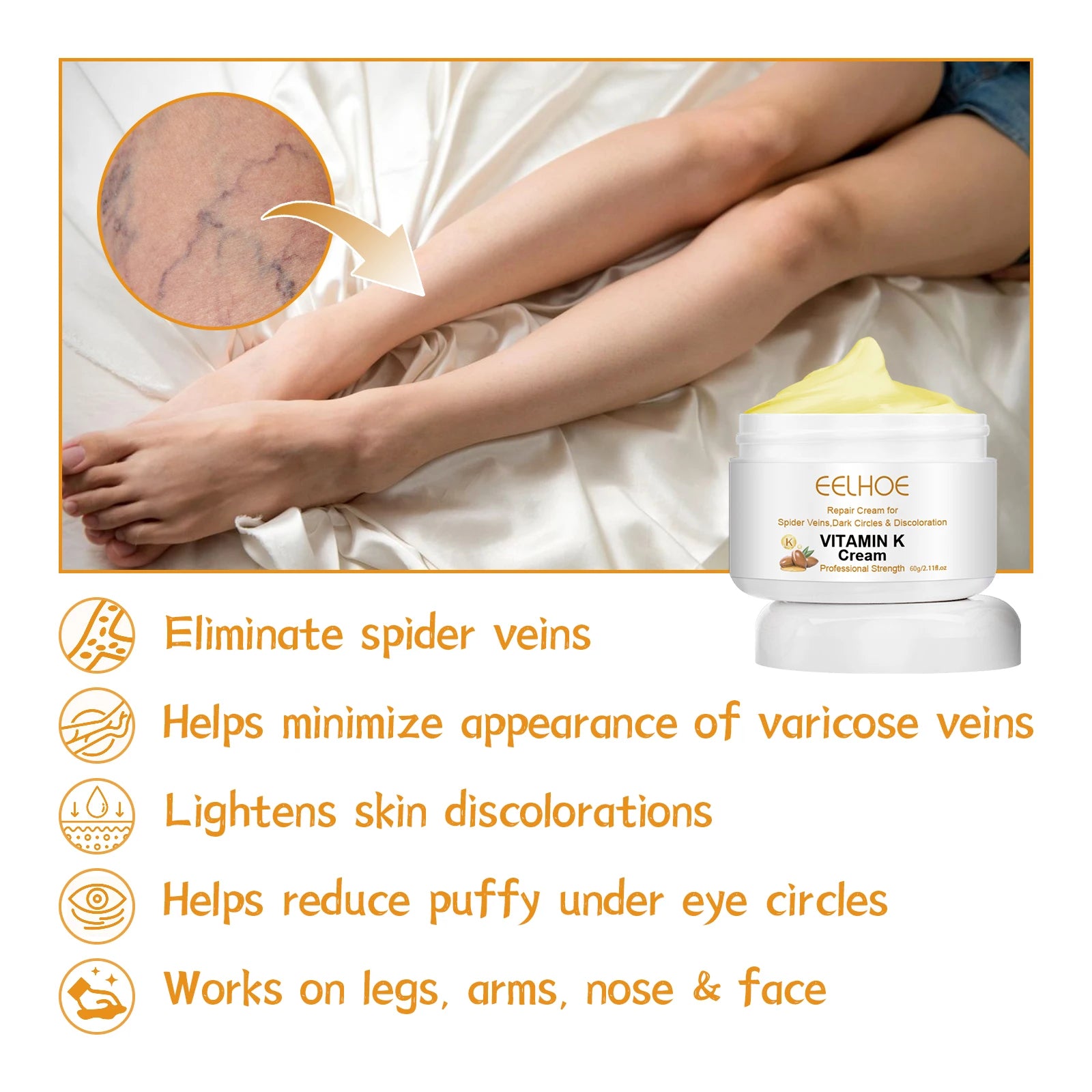 Vitamin K Cream for Varicose Veins, Spider Veins & Leg Care Vitamin K Skin Cream Zpaxo