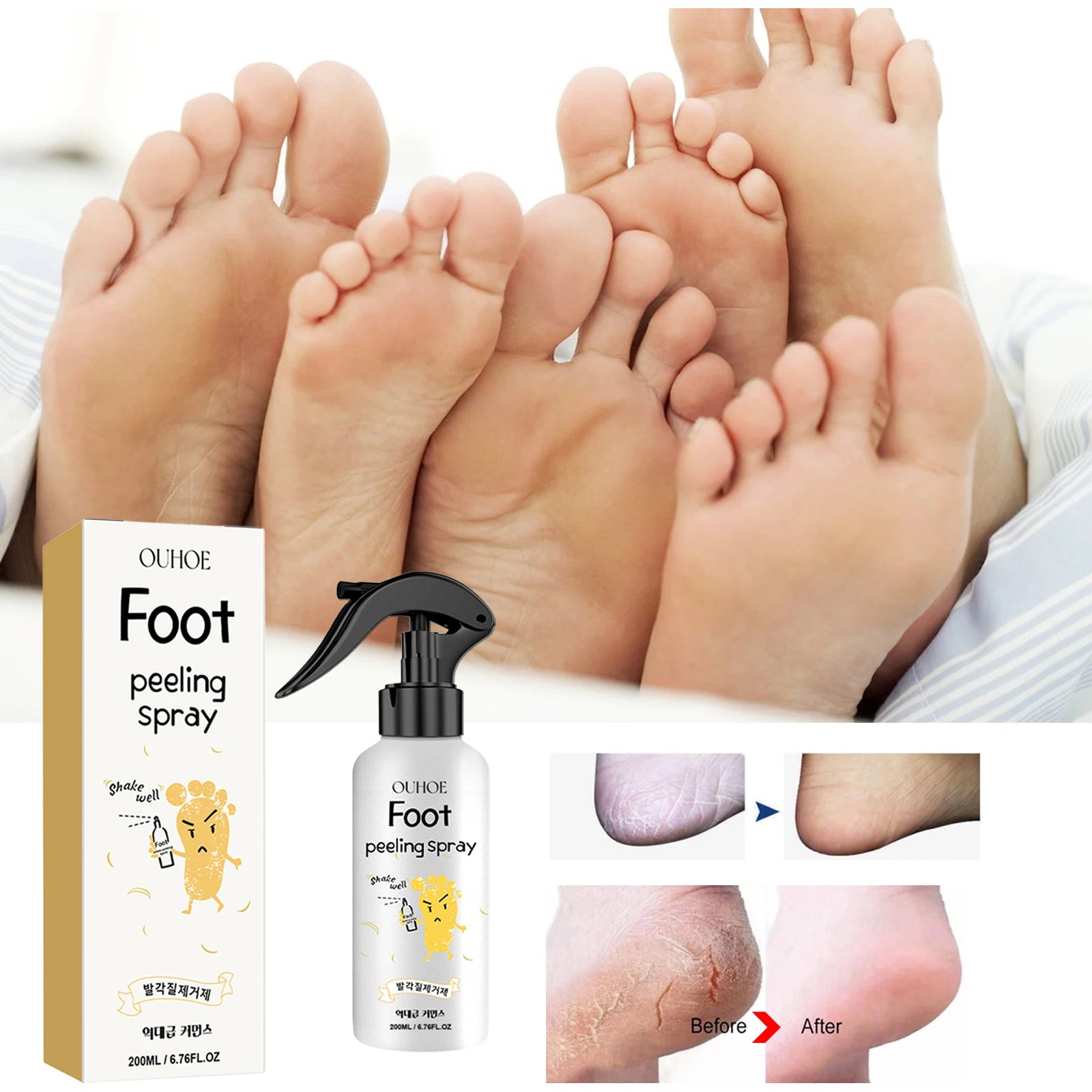 Foot Callus Remover Spray Quickly Soften Calluses Exfoliation Dry Zpaxo