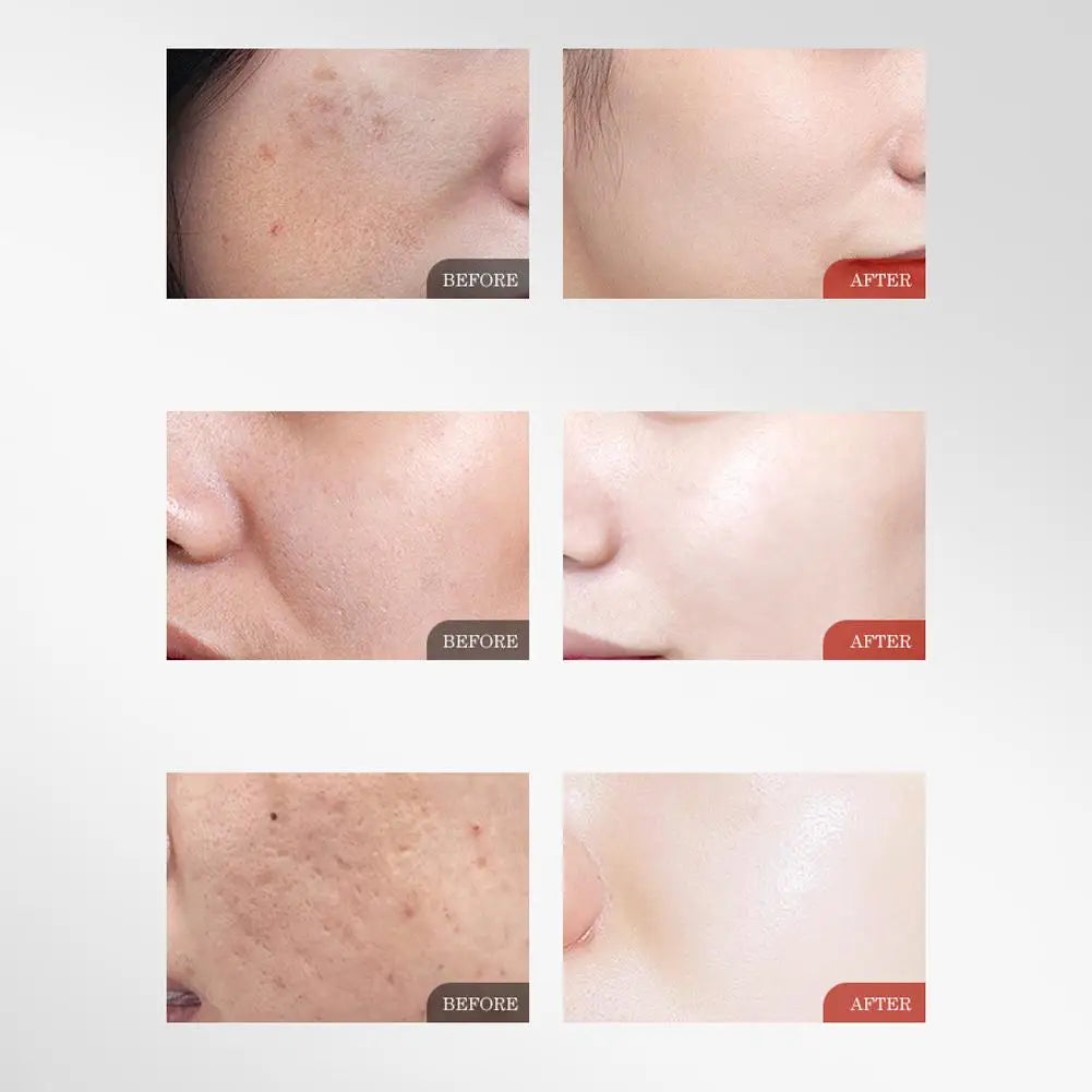 Lifting Essence Lotion 100ml Wrinkle Reduction For Sensitive Skin Moisturizing And Hydrating Improve Skin Elasticity Firmness Zpaxo