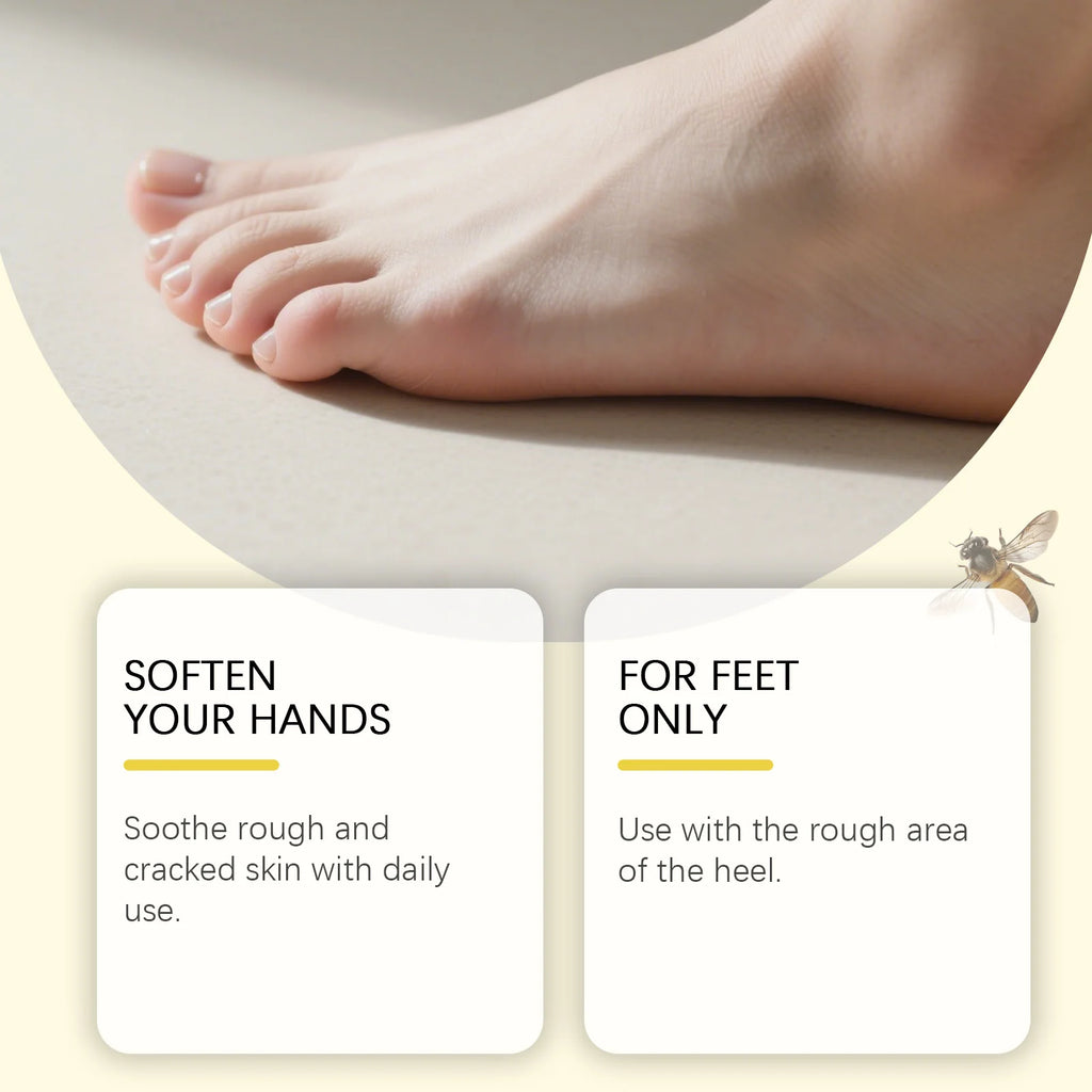 Hoygi 40% Urea Foot & Hand Cream – Cracked Heel Moisturizer Foot & Hand Cream Zpaxo