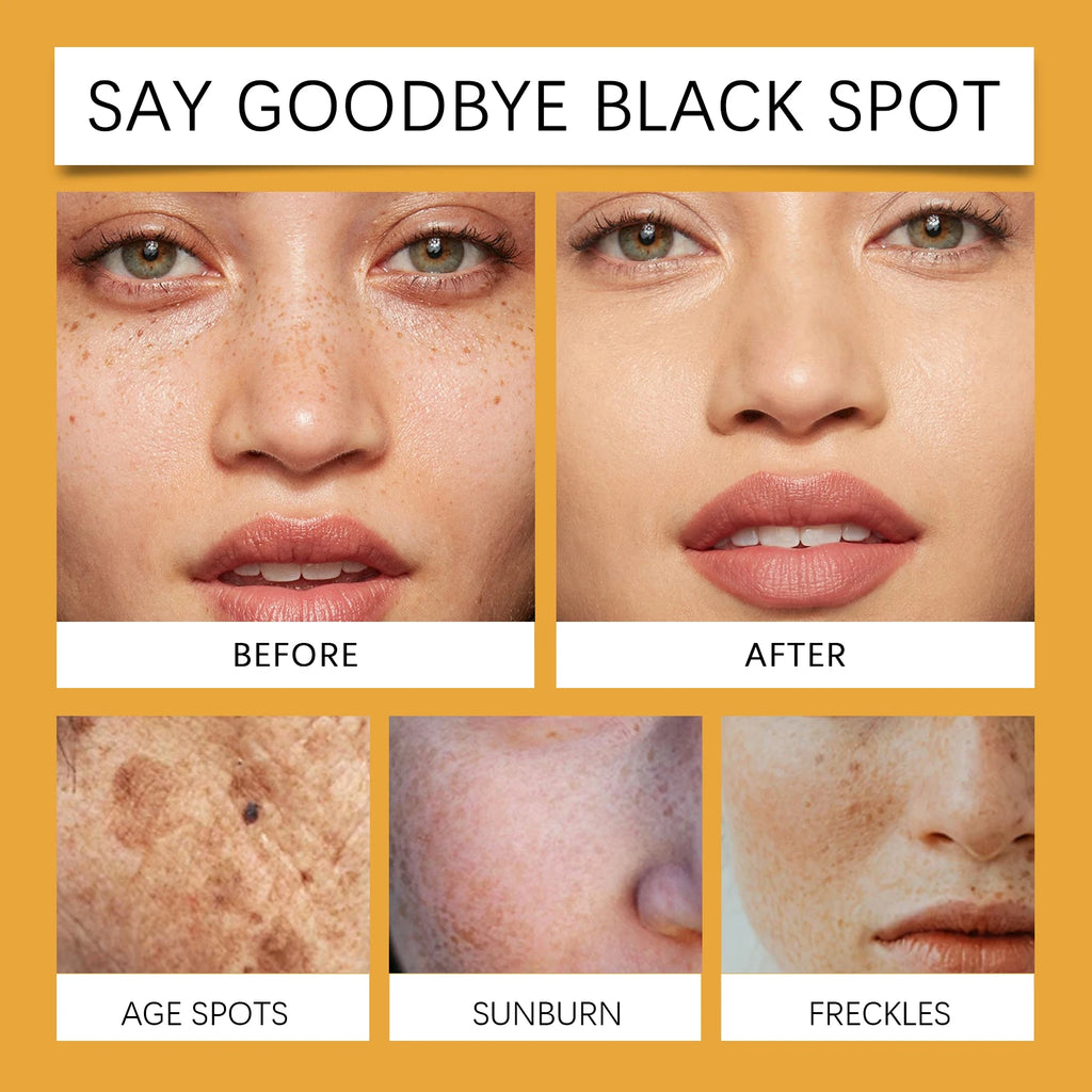 Ouhoe 3-in-1 Anti-Aging Skin Stick 30g Retinol Vitamin C Niacinamide Targeted Repair Firm Brighten Hydrate Portable Beauty Balm Zpaxo